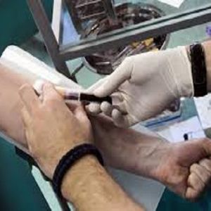 Blood Test for Kidney Functions at Home 