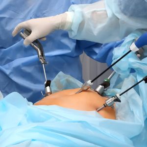 Laparoscopic Surgery in Dubai