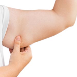 The Pros And Cons Of Arm Lift Surgery In Dubai