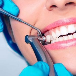 The Sparkle of Dubai's Smiles: Teeth Cleaning at Its Finest